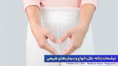 ترشحات زنانه